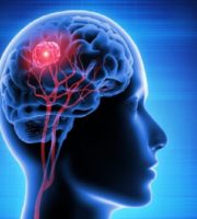What are the causes of brain tumors